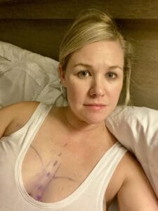 Finding Strength in My One Boob Reflection – McCall Dempsey